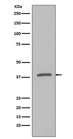 IkB-alpha, p Ser32 Antibody (SR1656), Novus Biologicals™