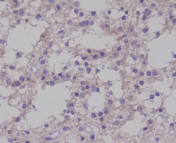 TrkB, p Tyr817 Antibody (SR1158), Novus Biologicals 100 &mu;g; Unconjugated:Antibodies,
