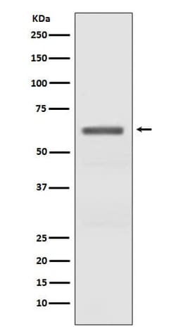 AMPK alpha 1/2, p Thr172 Antibody (SR2077), Novus Biologicals 100 &mu;g;