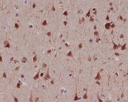 MSK1/RPS6KA5, p Ser376 Antibody (SR2276), Novus Biologicals:Antibodies:Primary