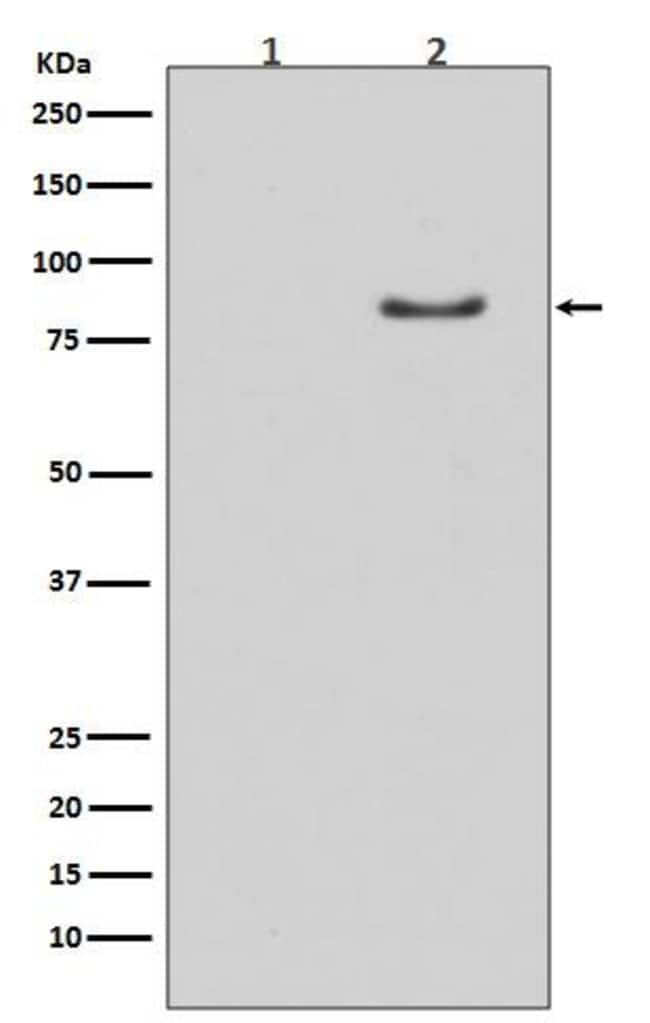 Hormonesensitive Lipase/HSL, p Ser853 Antibody (SR2248), Novus