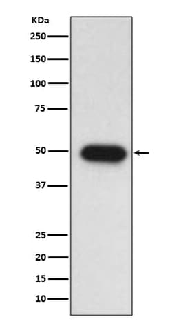 TGF-beta 1 Antibody (SR1847), Novus Biologicals:Antibodies:Primary Antibodies