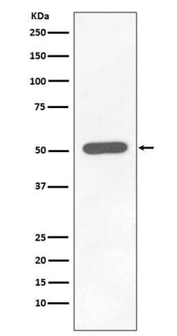 Chk1, p Ser296 Antibody (SR1961), Novus Biologicals 50 &mu;g; Unconjugated:Antibodies,