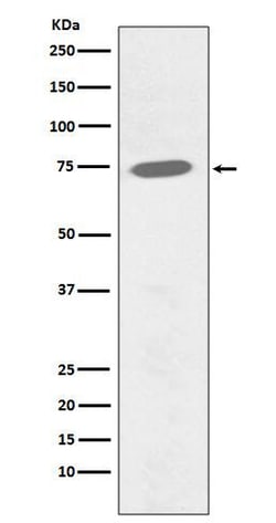 BTK, p Tyr551 Antibody (SR2188), Novus Biologicals 50 &mu;g; Unconjugated:Antibodies,