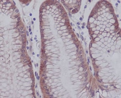 YAP1, p Ser127 Antibody (SR2105), Novus Biologicals 100 &mu;g; Unconjugated:Antibodies,