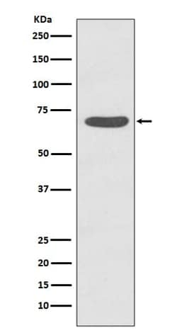 PKC zeta, p Thr560 Antibody (SR2127), Novus Biologicals 100 &mu;g; Unconjugated:Anticuerpos