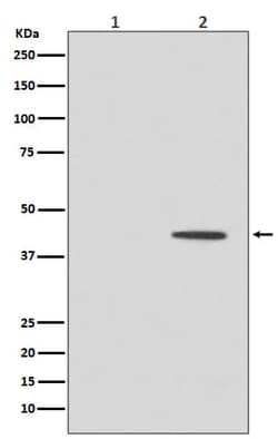 MEK1, p Thr292 Antibody (SR1773), Novus Biologicals:Antibodies:Primary