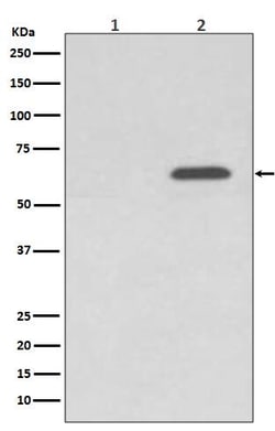 AMPK alpha 2, p Ser345 Antibody (SR2089), Novus Biologicals 100 &mu;g;