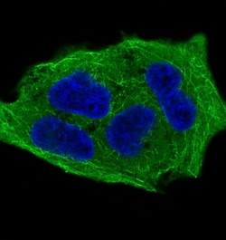 GSK-3 beta, p Ser9 Antibody (SR1801), Novus Biologicals 50 &mu;g; Unconjugated:Antibodies,