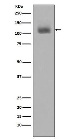 Jak2, p Tyr1007 Antibody (SR1129), Novus Biologicals 50 &mu;g; Unconjugated:Antibodies,