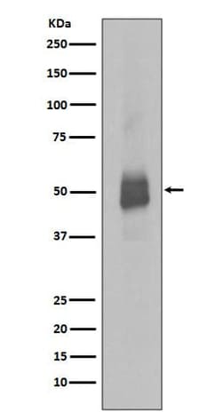 Lyn, p Tyr396 Antibody (SR2011), Novus Biologicals:Antibodies:Primary Antibodies