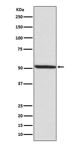 IRF3, p Ser386 Antibody (SR1819), Novus Biologicals 100 &mu;g; Unconjugated:Antibodies,
