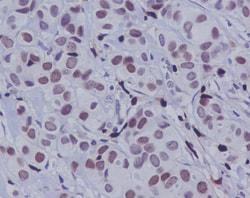 c-jun, p Ser63 Antibody (SR1842), Novus Biologicals 100 &mu;g; Unconjugated:Antibodies,