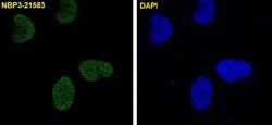 c-jun, p Ser63 Antibody (SR1842), Novus Biologicals 100 &mu;g; Unconjugated:Antibodies,