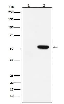 MLKL, p Ser358 Antibody (SR1963), Novus Biologicals 100 &mu;g; Unconjugated:Antibodies,