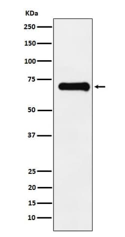 PAK4+5+6, p Ser474 Antibody (SR2087), Novus Biologicals 50 &mu;g; Unconjugated:Antibodies,