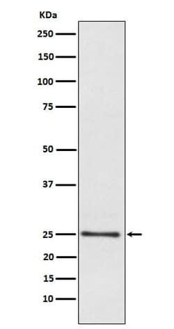 LYPLA1 Antibody (SR1383), Novus Biologicals 100 &mu;g; Unconjugated:Antibodies,