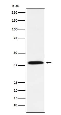 IkB-alpha, p Ser36 Antibody (SR1657), Novus Biologicals 50 &mu;g; Unconjugated:Antikroppar