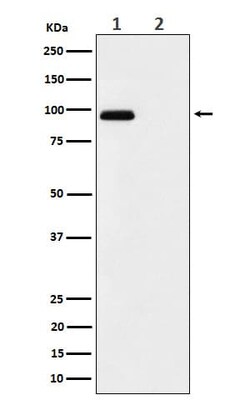 FGFR3, p Tyr724 Antibody (SR2305), Novus Biologicals 100 &mu;g; Unconjugated:Antibodies,