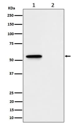MLKL, p Ser345 Antibody (SR1962), Novus Biologicals 50 &mu;g; Unconjugated:Antibodies,