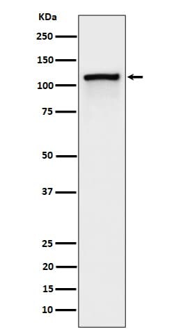 CBL, p Tyr774 Antibody (SR1098), Novus Biologicals:Antibodies:Primary Antibodies