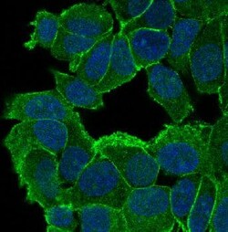 p120-catenin Antibody (SR1036), Novus Biologicals:Antibodies:Primary Antibodies