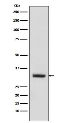 enkurin Antibody (SR1480), Novus Biologicals:Antibodies:Primary Antibodies