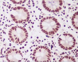 PTBP2 Antibody (SR2022), Novus Biologicals 50 &mu;g; Unconjugated:Antibodies,