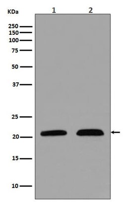 p21/CIP1/CDKN1A Antibody (SR1331), Novus Biologicals 100 &mu;g; Unconjugated:Antibodies,