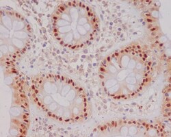 p21/CIP1/CDKN1A Antibody (SR1331), Novus Biologicals 100 &mu;g; Unconjugated:Antibodies,