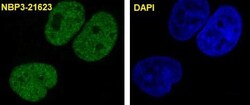 p21/CIP1/CDKN1A Antibody (SR1331), Novus Biologicals 100 &mu;g; Unconjugated:Antibodies,