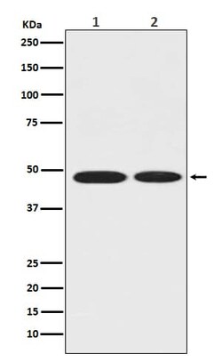 Enolase 1 Antibody (SR1812), Novus Biologicals 100 &mu;g | Buy Online | Novus Biologicals | Fisher Scientific
