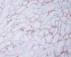 Collagen I Antibody (SR1143), Novus Biologicals 100 &mu;g | Buy Online | Novus Biologicals | Fisher Scientific