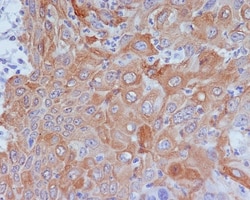 GM130/GOLGA2 Antibody (SR1125), Novus Biologicals 100 &mu;g; Unconjugated:Antibodies,