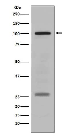 PMEL17/SILV Antibody (SR1021), Novus Biologicals 100 &mu;g; Unconjugated:Antibodies,