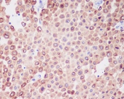 PMEL17/SILV Antibody (SR1021), Novus Biologicals 100 &mu;g; Unconjugated:Antibodies,