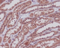 MEK1/2 Antibody (SR1751), Novus Biologicals:Antibodies:Primary Antibodies