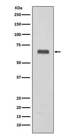Complement Component C9 Antibody (SR2144), Novus Biologicals 100 &mu;g;