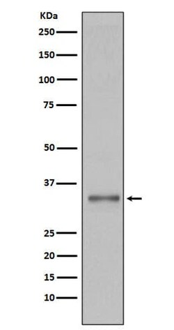 Torsin A Antibody (SR1592), Novus Biologicals 100 &mu;g | Buy Online | Novus Biologicals | Fisher Scientific