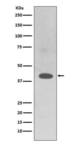 TRAM2 Antibody (SR1741), Novus Biologicals 100 &mu;g; Unconjugated:Antibodies,