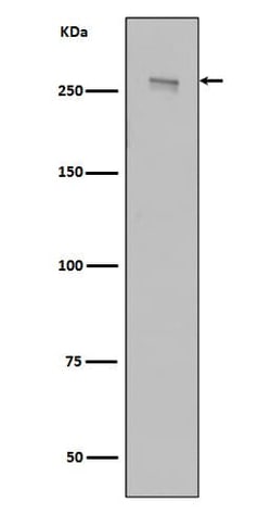 LRRK2 Antibody (SR1452), Novus Biologicals 100 &mu;g; Unconjugated:Antibodies,