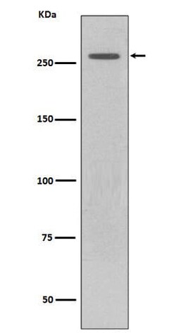LRRK2 Antibody (SR1451), Novus Biologicals 100 &mu;g; Unconjugated:Antibodies,