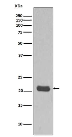 HRAS Antibody (SR1327), Novus Biologicals:Antibodies:Primary Antibodies