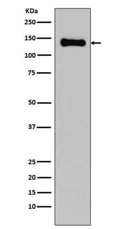 pan Cadherin Antibody (SR1156), Novus Biologicals:Antibodies:Primary Antibodies