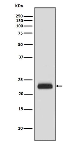 RAIDD/CRADD Antibody (SR1368), Novus Biologicals:Antibodies:Primary Antibodies