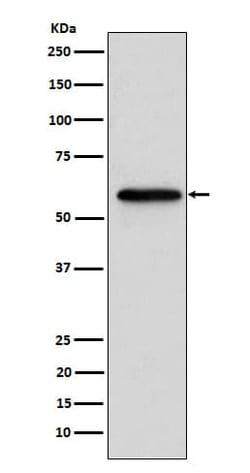 RAR beta/NR1B2 Antibody (SR1998), Novus Biologicals:Antibodies:Primary