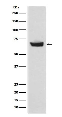CETP Antibody (SR1985), Novus Biologicals 50 &mu;g; Unconjugated:Antibodies,