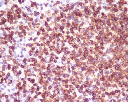 CD45 Antibody (SR1188), Novus Biologicals 100 &mu;g; Unconjugated:Antibodies,