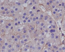 MMP-1 Antibody (SR1958), Novus Biologicals:Antibodies:Primary Antibodies