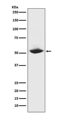 MMP-1 Antibody (SR1958), Novus Biologicals:Antibodies:Primary Antibodies